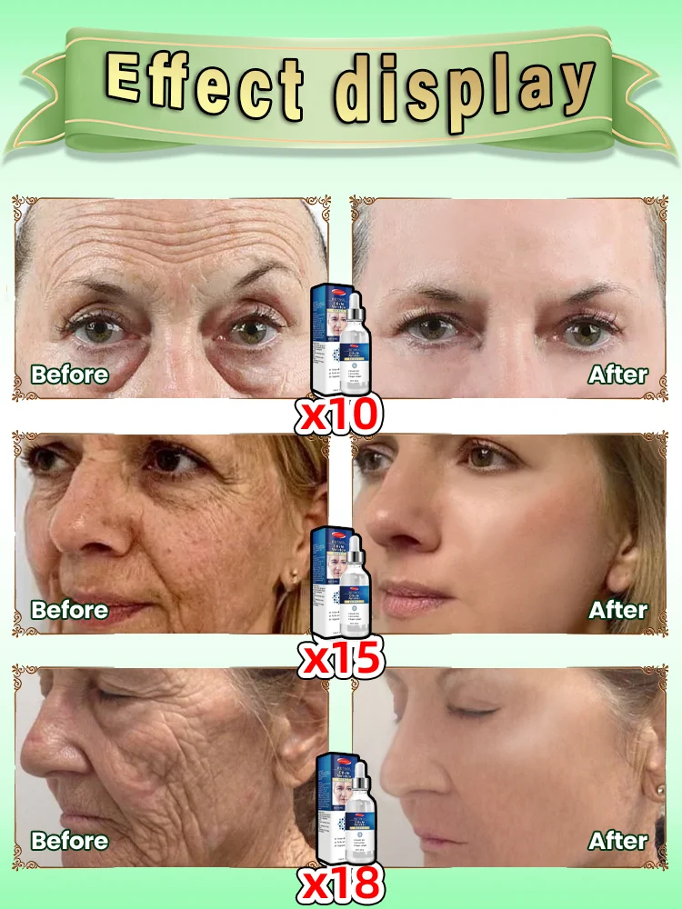 [Magia antienvejecimiento] Esencia antiarrugas levanta y reafirma para eliminar líneas finas y bolsas para los ojos