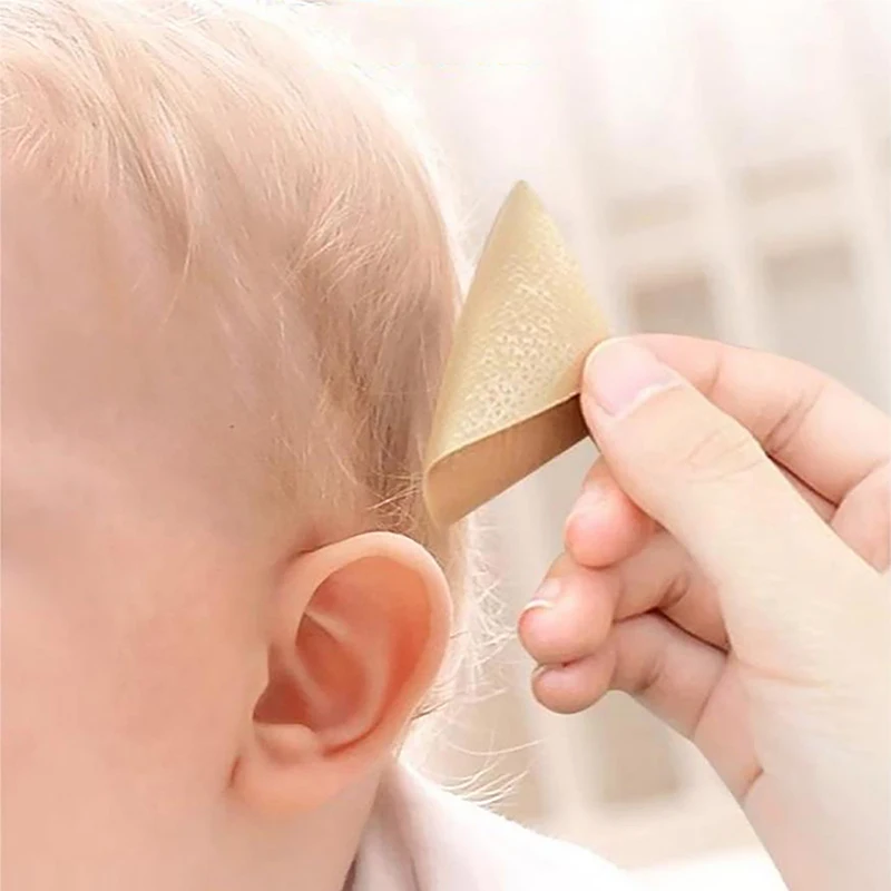 Baby Ear Corrector Cuttable Breathable Infant Toddler Auricle Valgus Silicone Correction Patch With Ear Support Patches