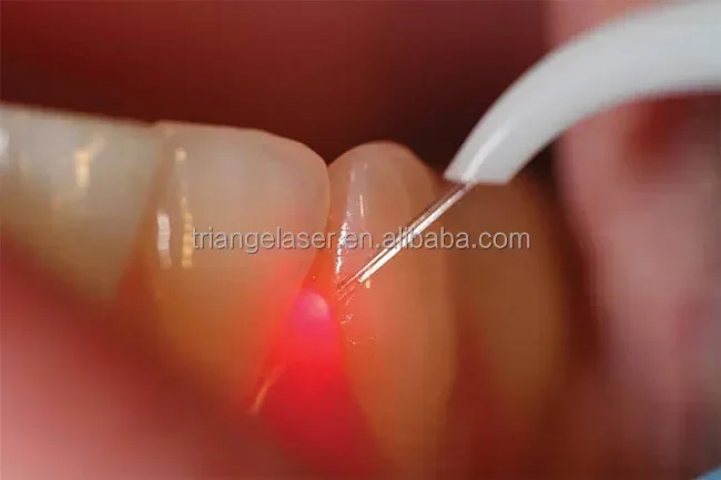 2023 laser de diodo dental de três comprimentos de onda para cirurgia de tecidos moles tratamento oral clareamento dos dentes equipamento de beleza