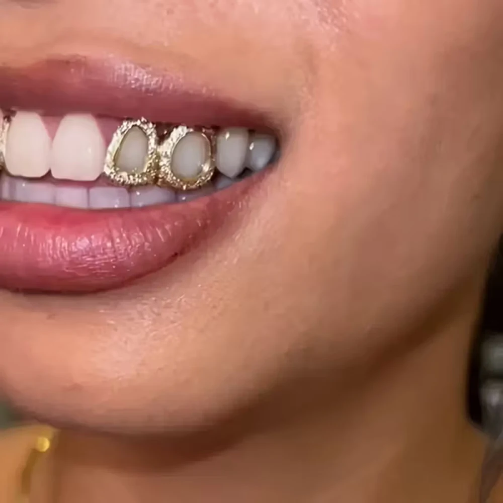 3Pcs Hip Hop Fashion Hollow-Out Shiny Teeth Accessory , Halloween Performance Props - Unisex Holiday Party Gift