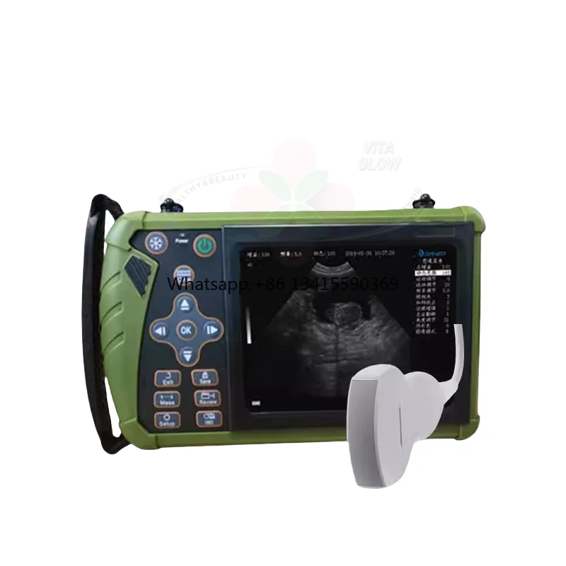 

For Sheep Cow Pig China Wireless Mobile Cheap Veterinary ultrasund Touch Scanner Machine