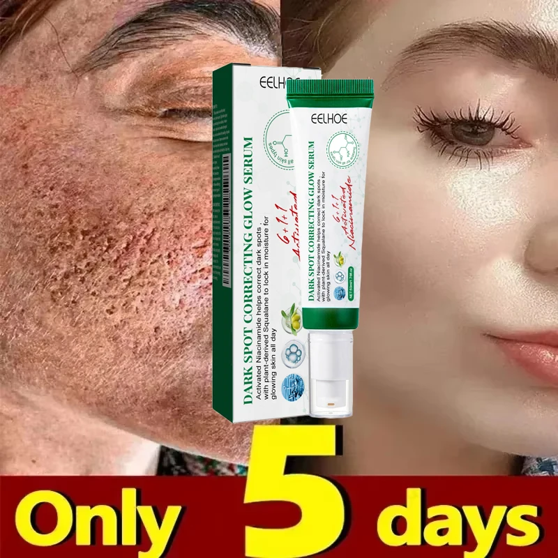 Pore Shrinking Cream Acne Pit Repair Product for Men Women Remove Acne Print Scar Large Pore Anti-inflammatory Smooth Skin Cream