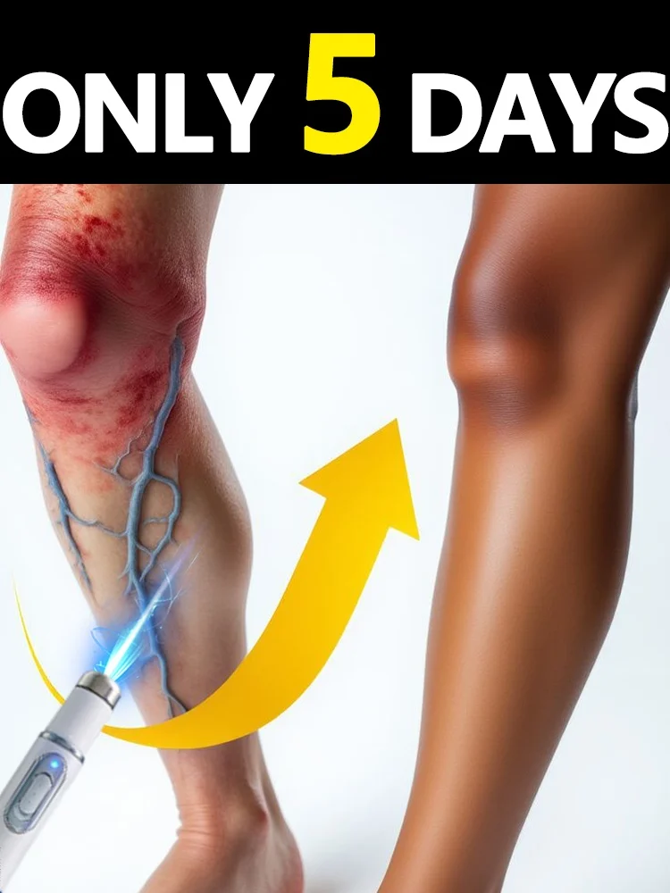 The new generation of products improves issues related to legs and feet and can be used by both men and women.
