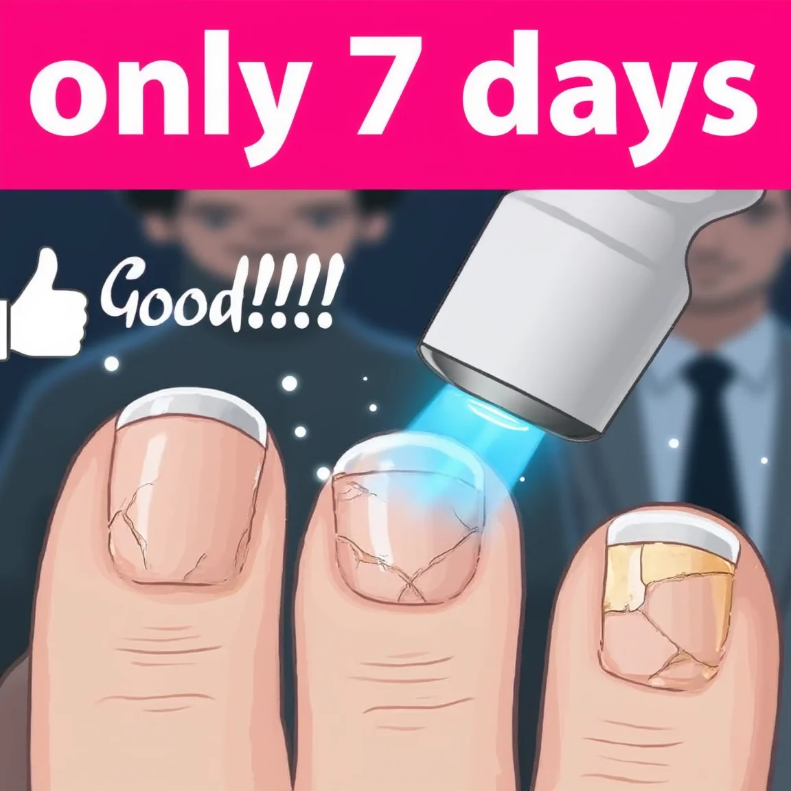 

Лазерная ручка для ногтей пятого поколения цвета шампань помогает вам избавиться от онихомикоза. Технологии меняют вашу жизнь.