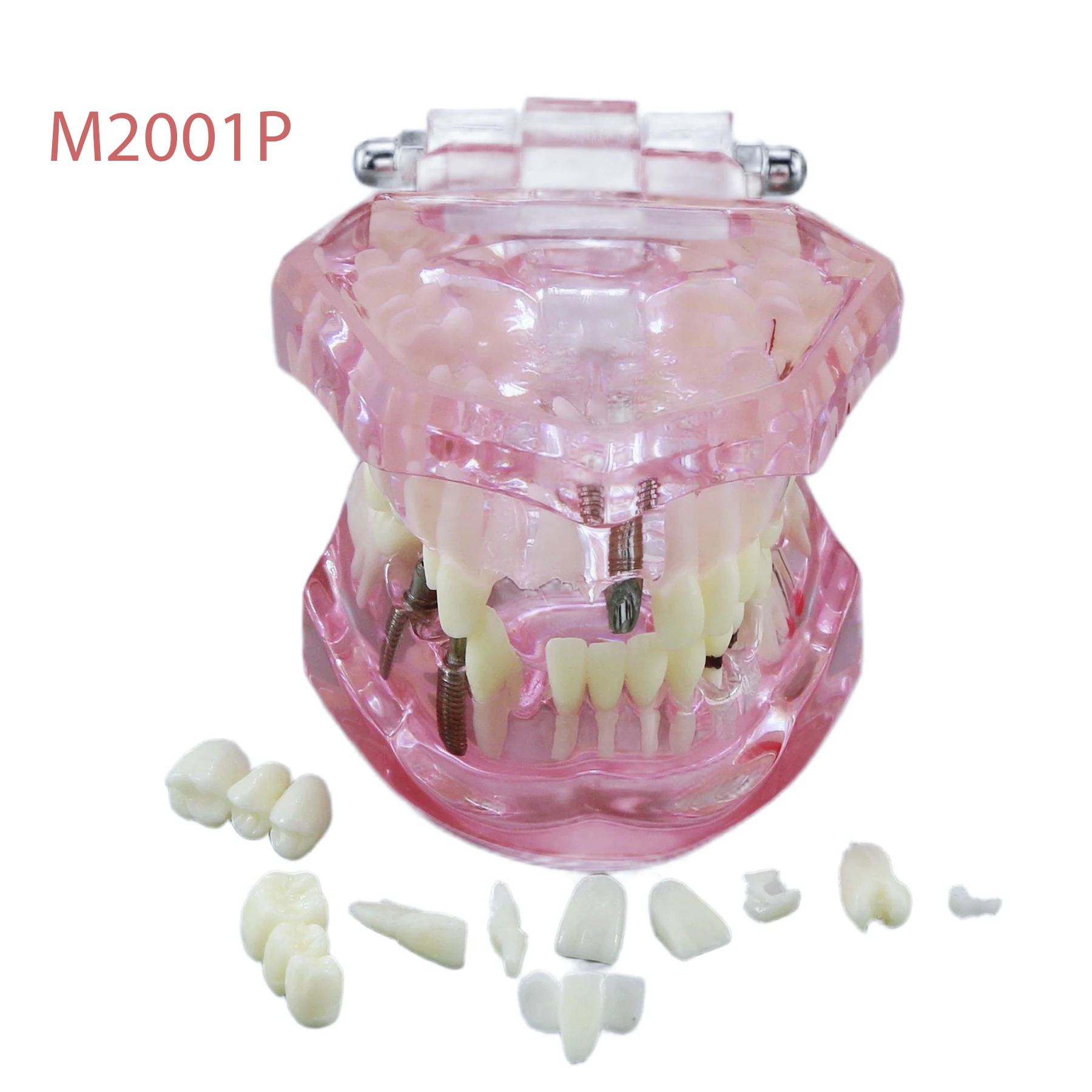 Teeth Model Oral Implant Restoration & Pathology M2001 Pink Used in student study