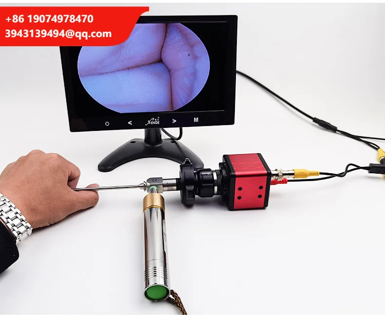 

HC-G022F Portable Machine Digital Otoscope 4mm High-definition Visual Endoscope Electronic Otoscope