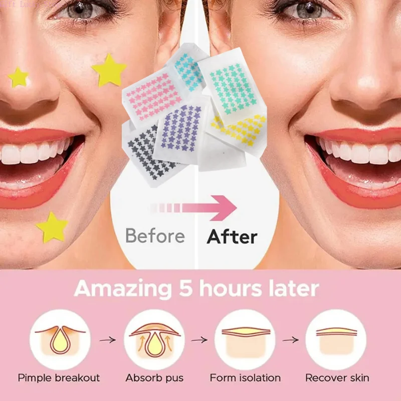 1 caixa cor acne remendo desaparecer reparação invisível remoção de acne adesivos bonito corretivo ferramenta de maquiagem estilo estrela com caixa de armazenamento espelho