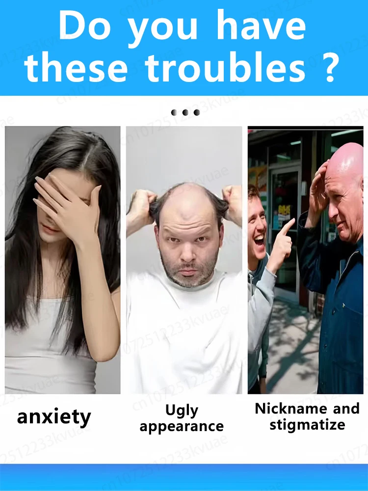 Wil je een vaarwel tegen haaruitval zeg? Onze producten kunnen de haarfollikels penetreren en helpen je haar regenereren