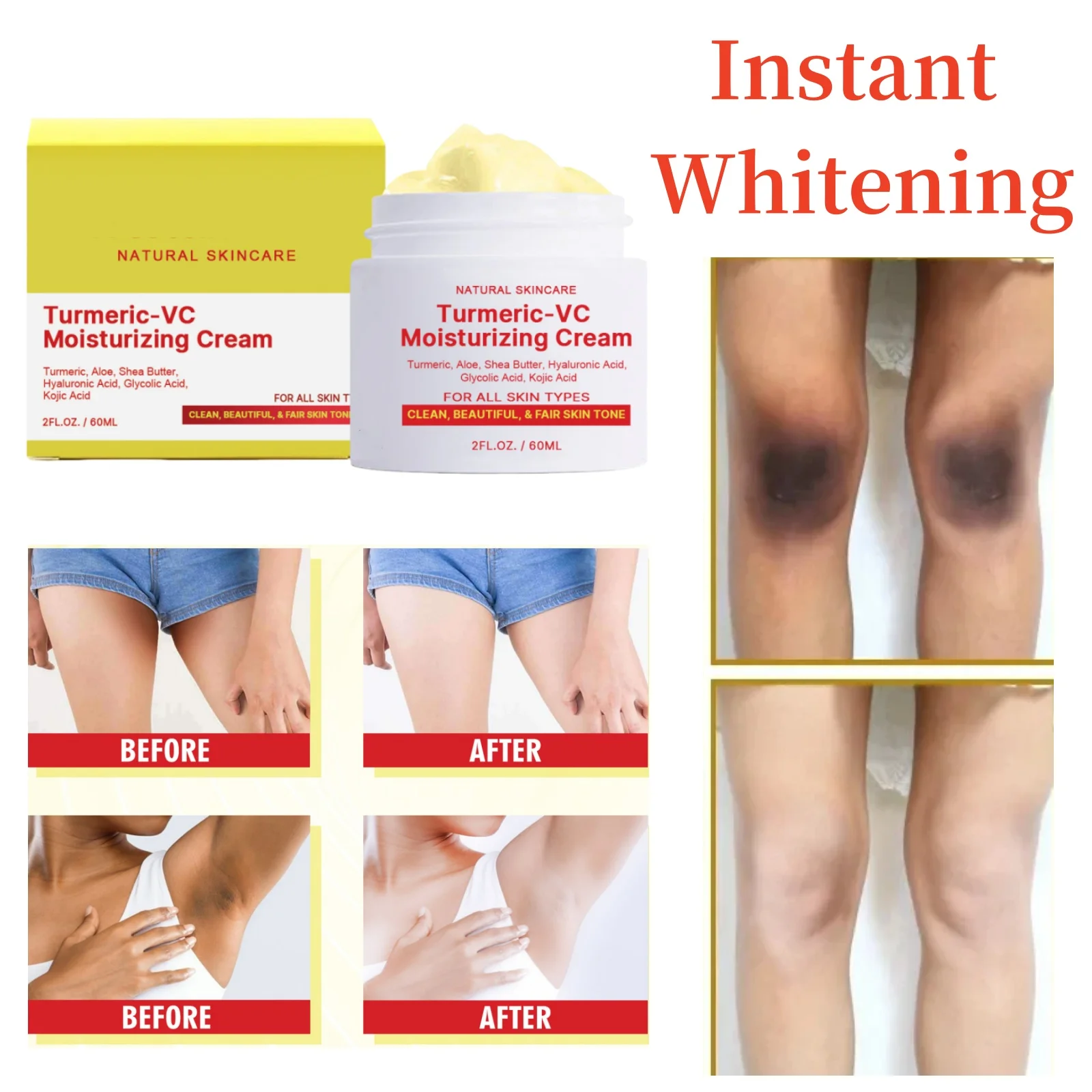 Body Brightening Cream Armpits Elbows Knees and Legs Melanin Removal Darkening Fading Pigment Dark Spots Bleaching Care Cream