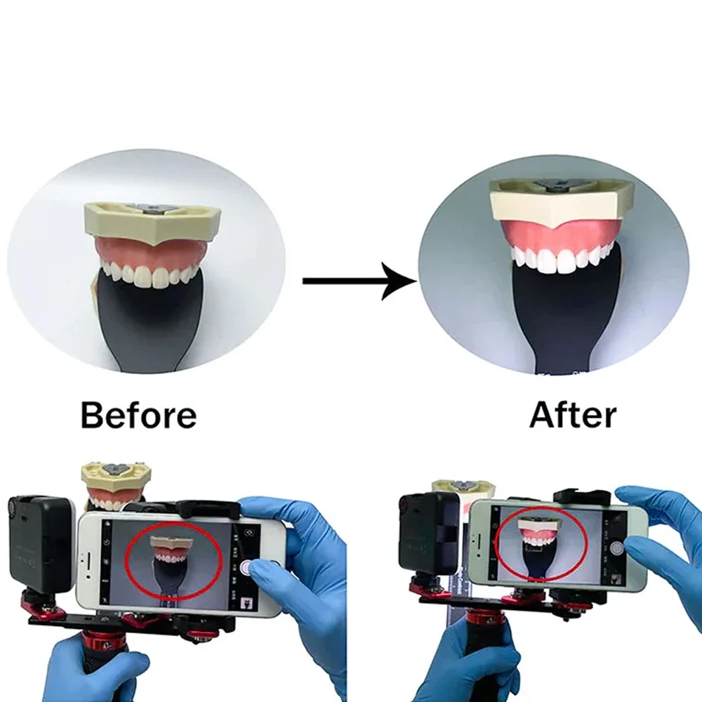 Dental Photography Light For Phone With Bluetooth. Oral Photo Lighting For Dentist. Denture Photography Lighting - Image 5