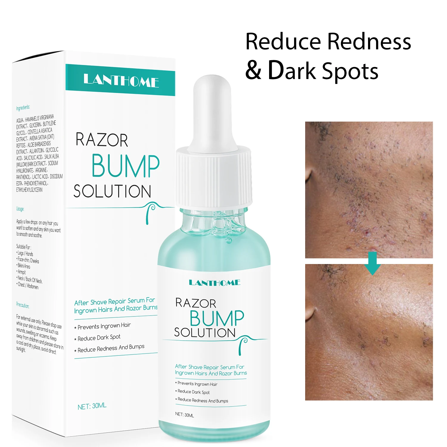 Lanthome Razor Bumps Removal Solution For Hair treatment After Shave Repair Dark Spot Reduce Redness Serum for vanish Skin Care