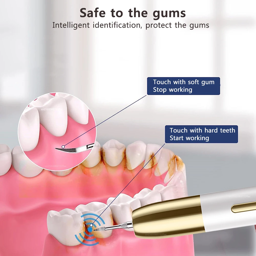 Raspador dental ultrassônico, eliminador de tártaro e removedor de cálculo de placa dentária, remoção de tártaro, limpador de dentes