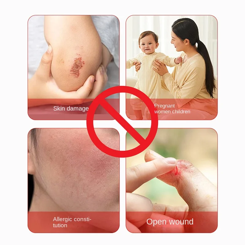 Thai Wine Lees Nose Cream Strawberry Nose Red Nose Blackhead Pore Wine Lees Thick Red Bloodshot Discomfort Health Care Cream