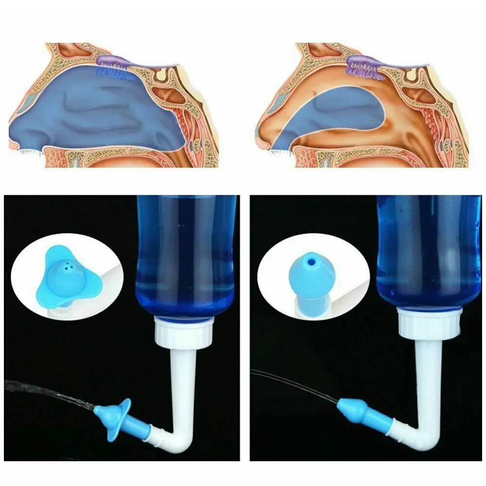 Irigator Nasal 300ml/500ml yang Ditingkatkan untuk Dewasa, Mencegah Alergi, Kontrol Otomatis, Pembersih Hidung