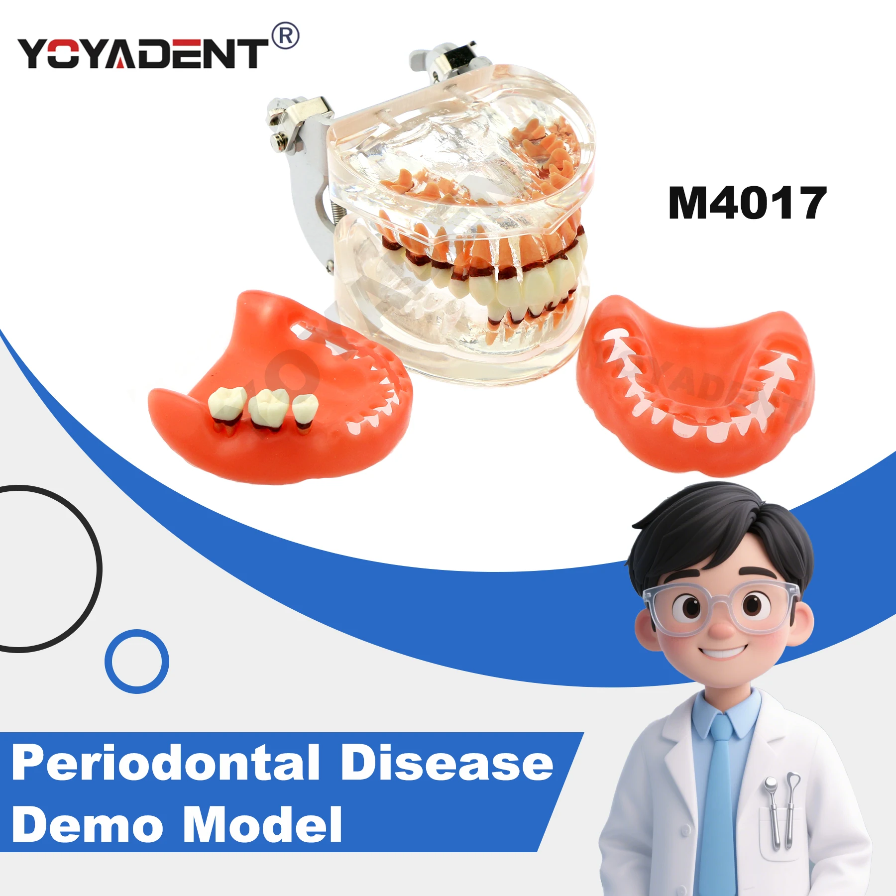 

M4017 Dental Model Pathological Resin Model Periodontal Disease Teaching Tool for Patient Education Demo Accessories