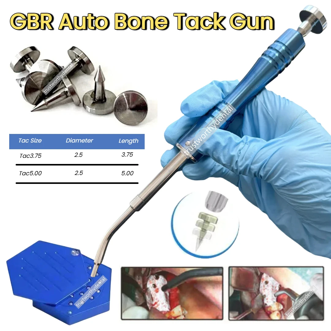 

Стоматологические GBR Bone TAC Pins Tacks Мембранная направляющая для пистолета Автоматический Tacker Titanium NITI