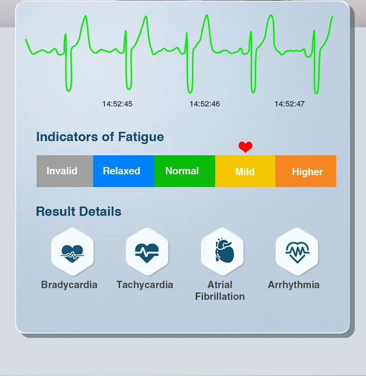 Boxym Mobiele Draagbare 24H Thuis Ekg Machine Voor Hart Elektrode Draagbare Elektrocardiograaf Draadloze Cardiale Ekg