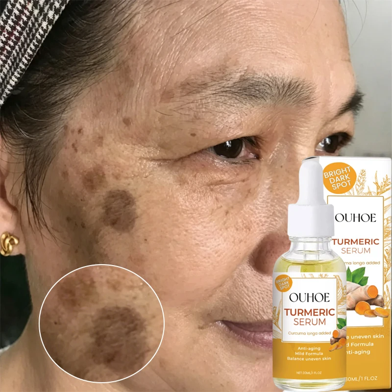Turmeric Face Serum Repair Melanin Freckle Pigment Correcting Brighten Lightening Moisturizer Nourish Smooth Shrink Pore Essence