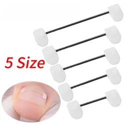 Professional Ingrown Toenail Correction Ingrown Toenail Corrector Tools Pedicure Recover Embed Toe Nail Treatment Foot Care Tool