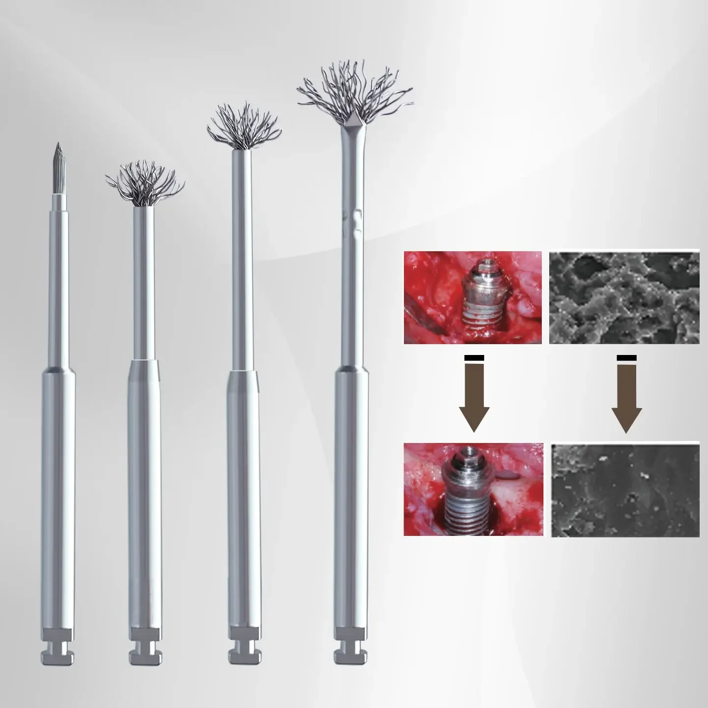 Dental Debridement Surface Threads Titanium Brush for  Restoration Maintenance  fast shipping