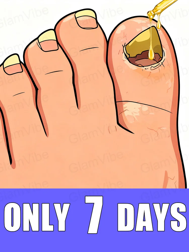 Ripristina il brillante naturale delle tue unghie in 7 giorni