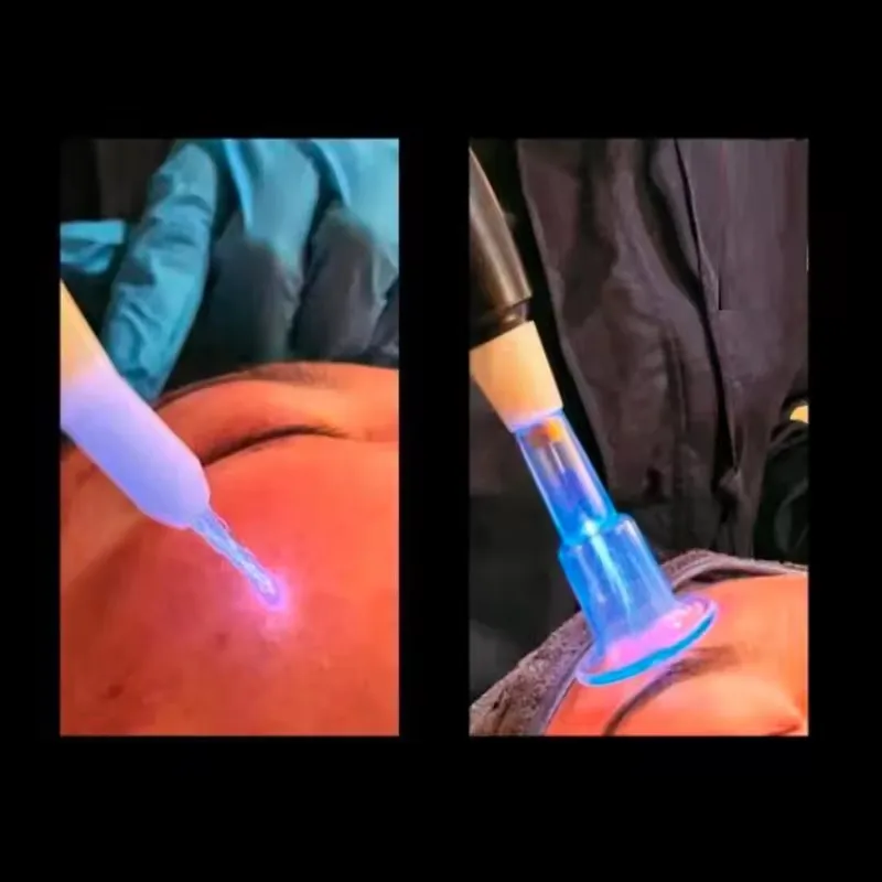 2025 latest technology integration plasma cold and hot ultra-cold jet scalp diamond stamp jet ozone-jet plasma machine