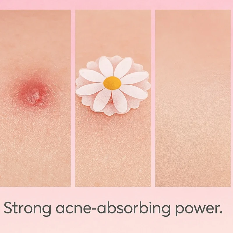 40/80/200개 꽃 모양 얼굴 피부 관리 여드름 패치 투명 전문 치유