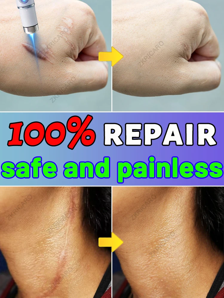 Sᴋɪɴ ʙᴇᴄᴏᴍᴇs sᴍᴏᴏᴛʜ ᴀɴᴅ sᴄᴀʀ-ғʀᴇᴇ