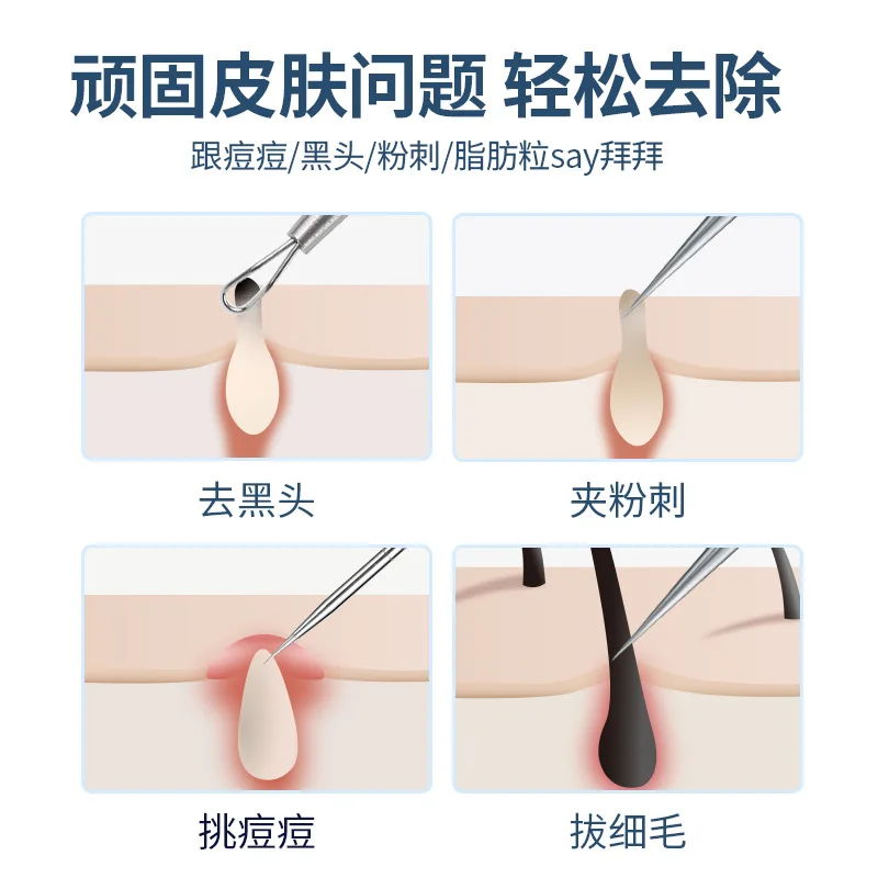 Acne Needle Blackhead Cell Clip Suit Double-Headed Acne Needle Black Head Removal Needle Tweezers Precision Acne Clip Skincare