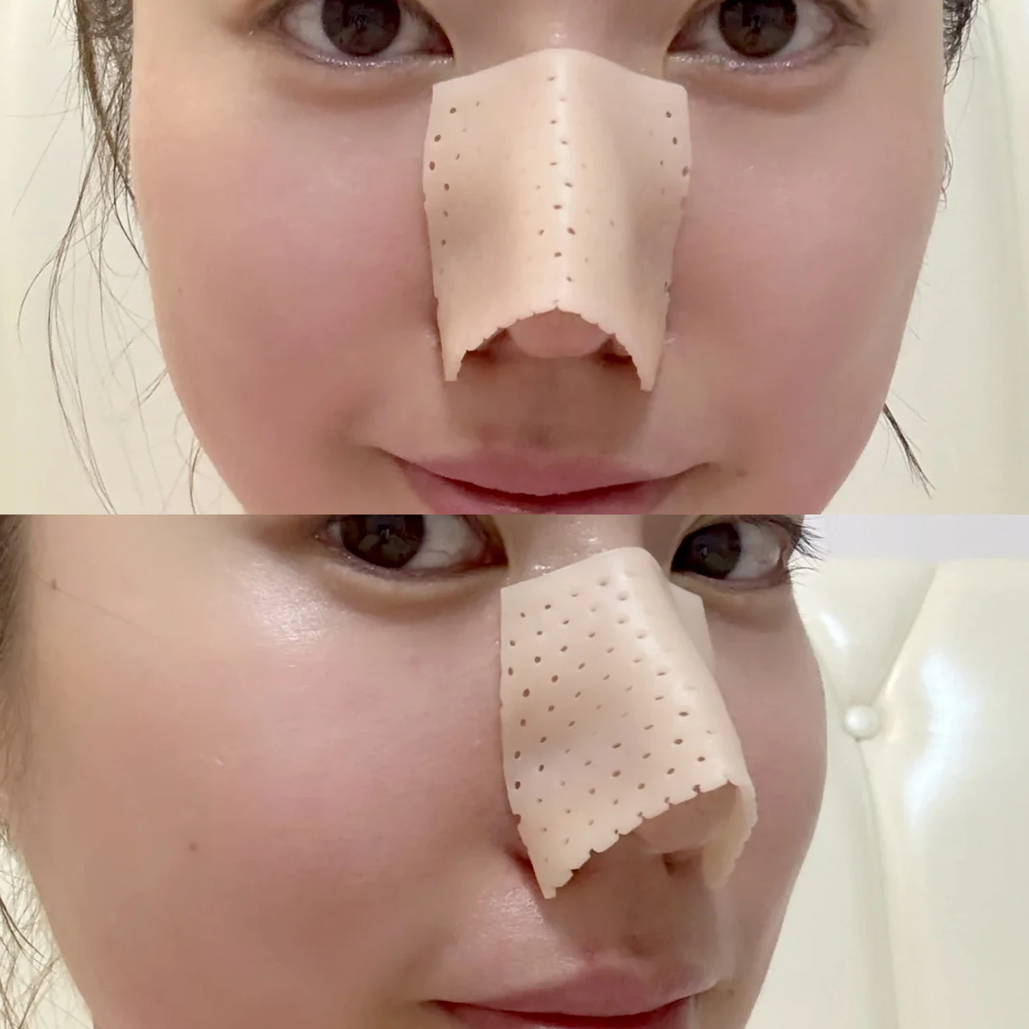 自己整形鼻副子低温熱可塑性鼻整形粘着テープ骨折副子外部サポート固定を提供