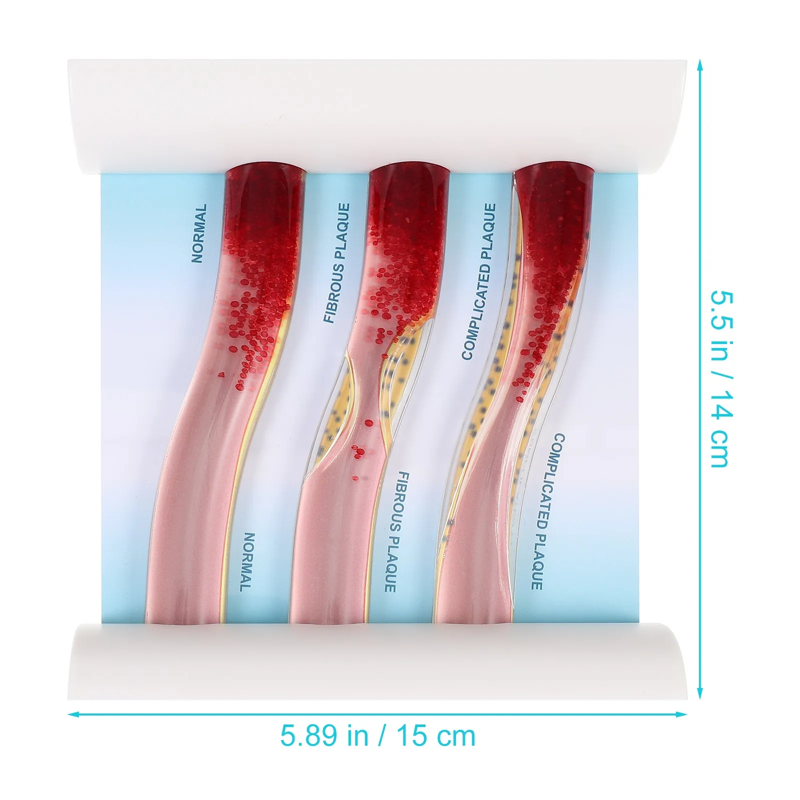 Teaching Aids Low-Density Lipoprotein Cholesterol Effect Vascular Display for Students and Professionals