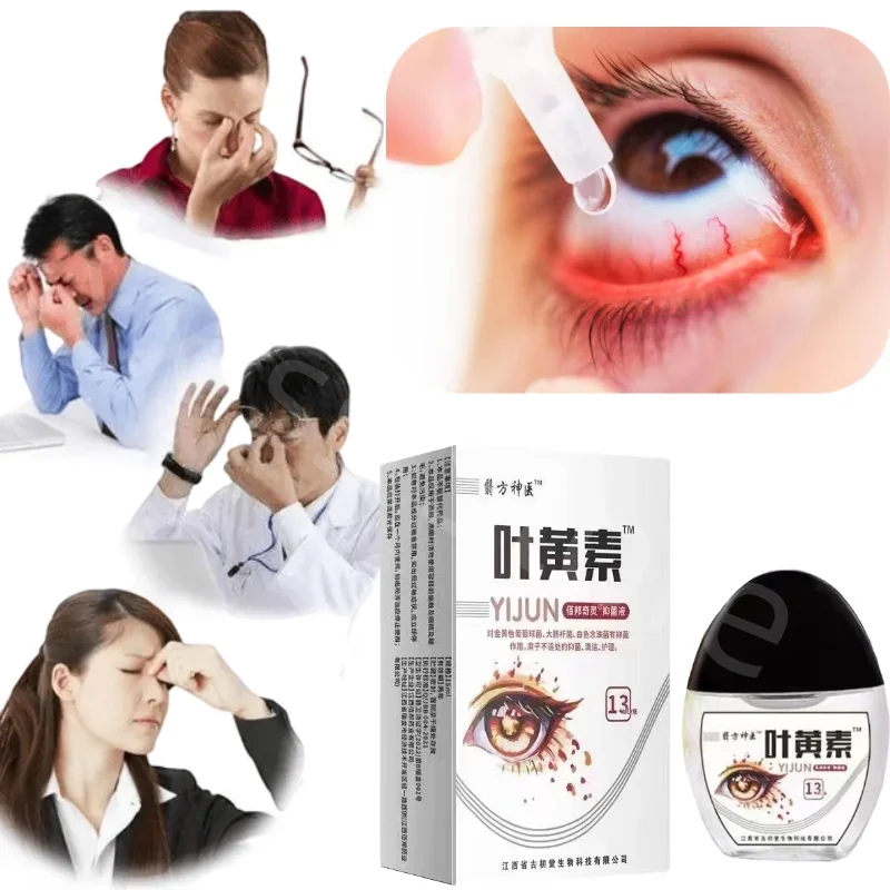 Lutein Eye Drops Relieve Eye Fatigue and Dryness Improve Vision Eye Care Eye Drops