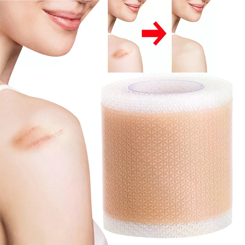 Silicone Scar Patch Nude Scar Tape Roll Scar Sheet Removal Self-Adhesive Tape Therapy Patch Burn  Surgical Scar Skincare