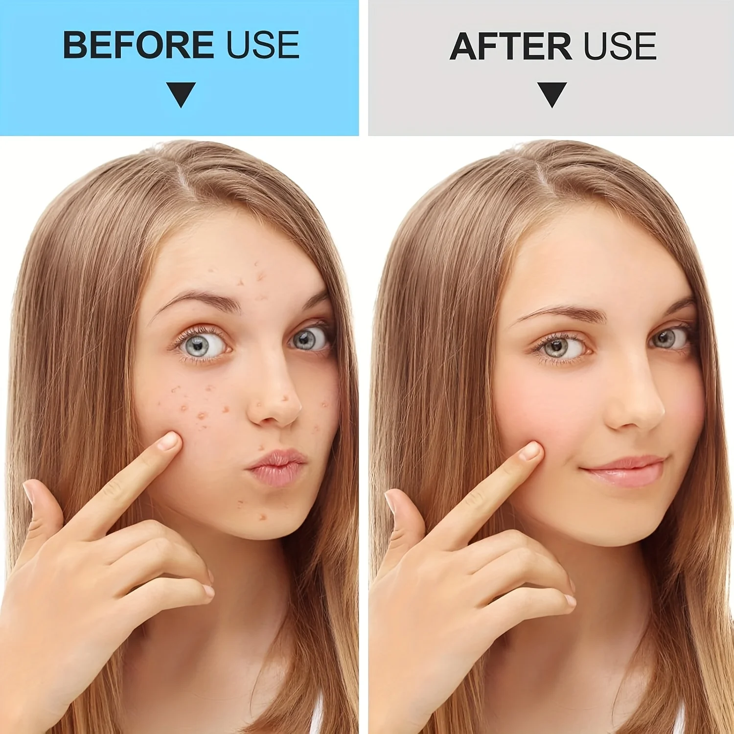 7-częściowy profesjonalny zestaw narzędzi do usuwania zaskórników ze stali nierdzewnej - zestaw do usuwania zaskórników z pęsetami, klipsem do komórek i ekstraktorem do twarzy