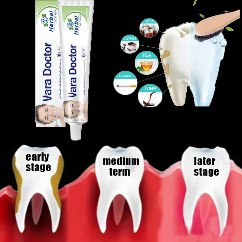 

Remover Dental Calculus Whitening Teeth Mouth Odor Removal Bad Breath Preventing Periodontitis Oral Health Care New 2024 0903