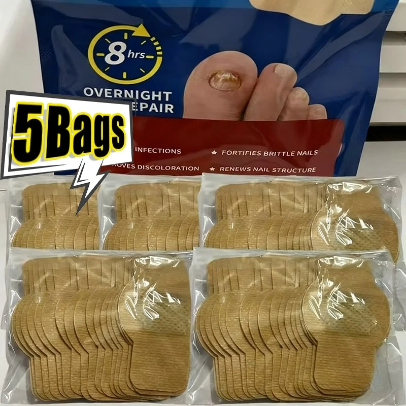 

5bags Wholesale Nail Fungus Patch Waterproof Nail Repair Ingrown Correction Sticker Damaged Nail Gray Care Patch Feet Care Tools