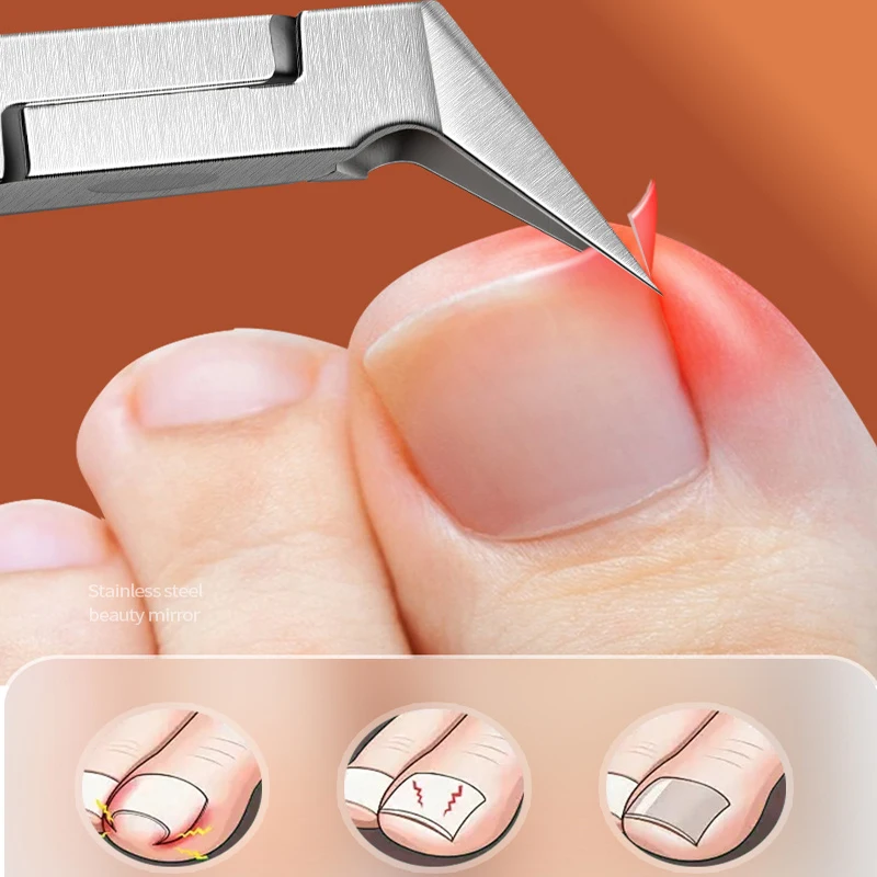 Toe Nail Clipper For Ingrown Thick Toenails Trimmer Stainless Steel Professional Podiatrist Toenail Nipper Ingrown Nail Clipper - Image 2
