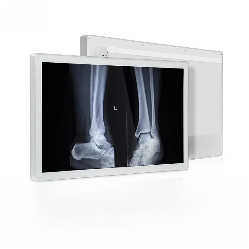 

Заводские продажи радиологический монитор 27 дюймов P270WQUGA-SDI 1000 нит высокое разрешение антибликовый 8MP медицинский монитор