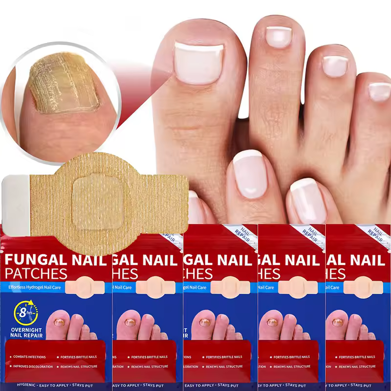Nail Repair Patches Toenail Fungus Patch Sticky Toenail Care Nail Ingrown Correction Sticker Paronychia Disposable Toe Patch - Image 3