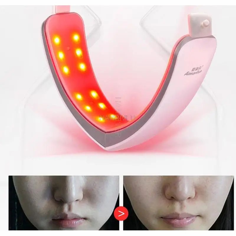 Chin V-Line Up Lift Belt Machine Red Blue Facial Lifting Device Face Slimming Vibration Massager V-Face Care