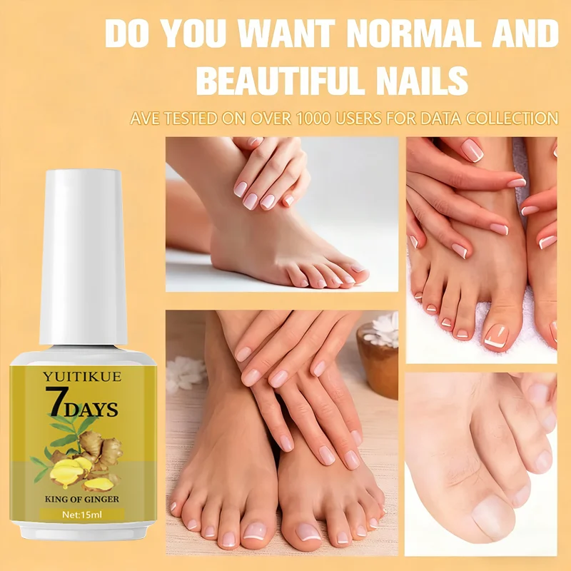 ยูอิทิคิว 7-เดย์ จินเจอร์ เนล แคร์ 15 มล. - ช่วยให้เล็บแข็งแรง เรียบเนียน และปกป้องเล็บ บำรุงหนังกำพร้าอย่างเข้มข้นเพื่อเล็บสวย