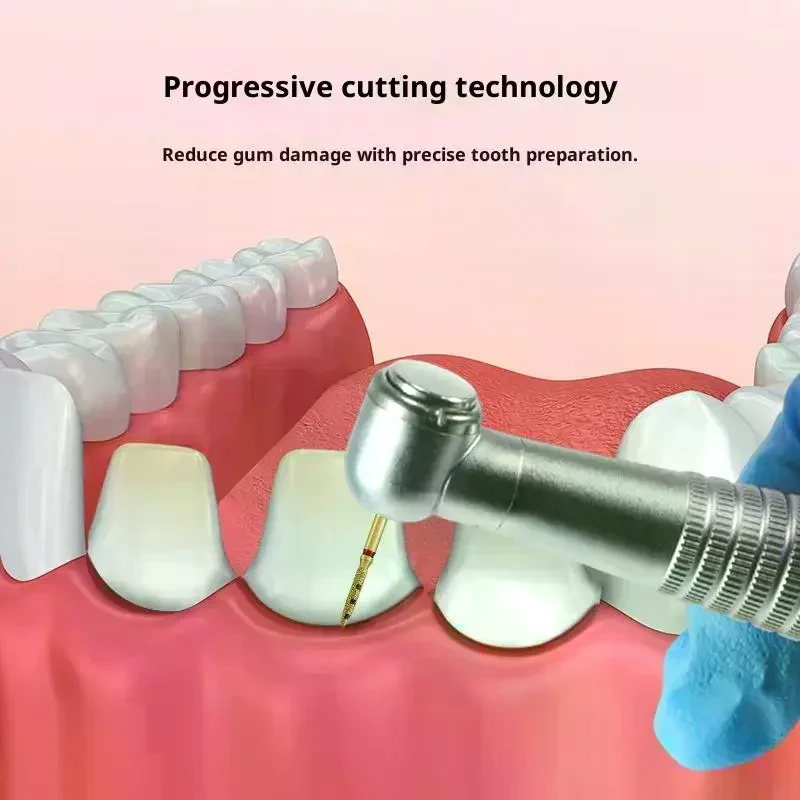 

6 шт./компл., стоматологический бор, вертикальный набор для подготовки зубов, реставрационный комплект, полная корона, реставрация, стоматологические инструменты