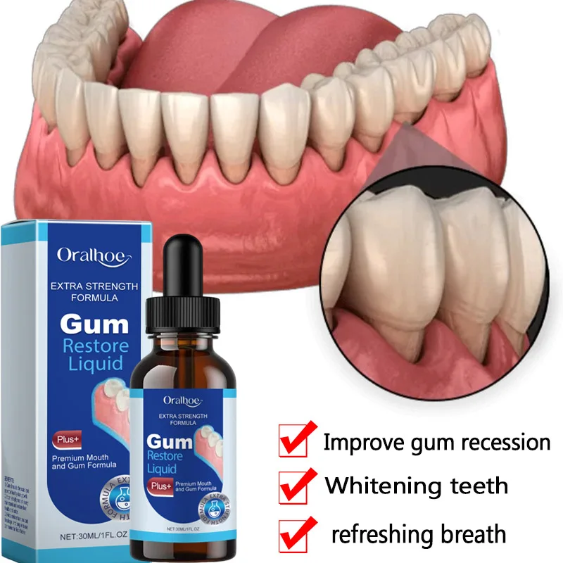 Rapid Damaged Gum Repair Care Serum Relieve Tooth Allergy Dental Caries Tooth Cleaning Toothpaste Relieve Tooth Damage Drops