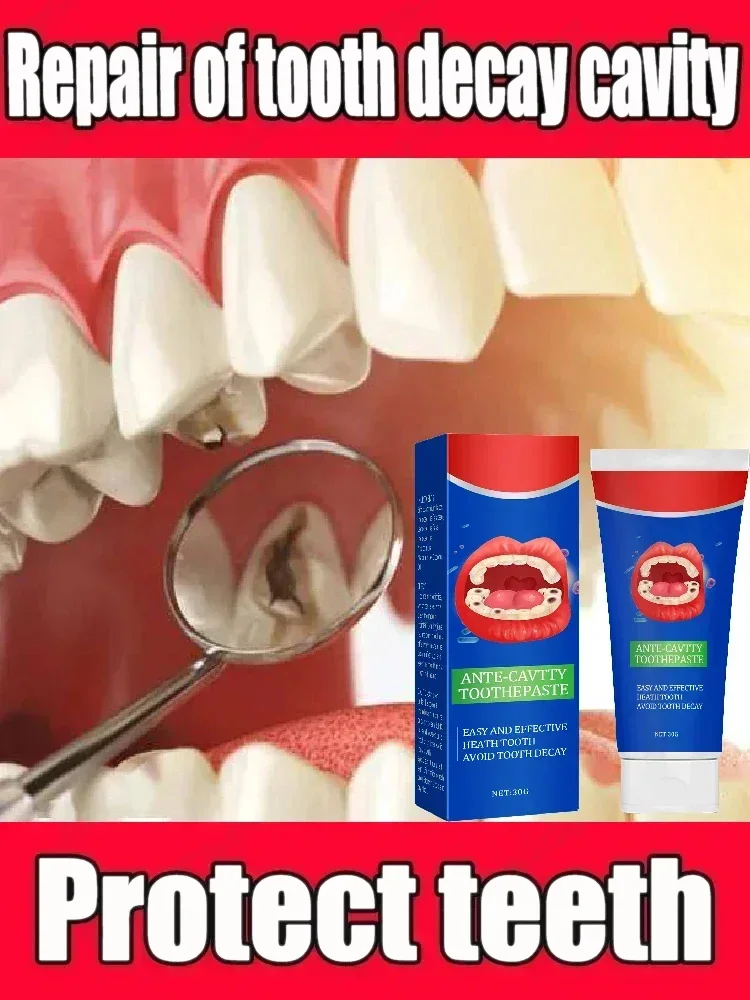 Anti Decay Toothpaste Dental Caries Repair Cream Prevent Tooth Decay Protect Teeth 30g Dental Care Tool