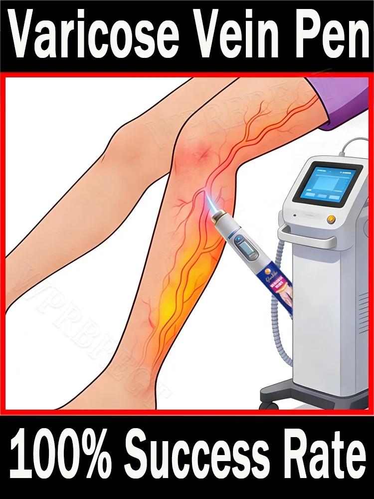 

Blue light pen for veins: Addressing venous valve problems