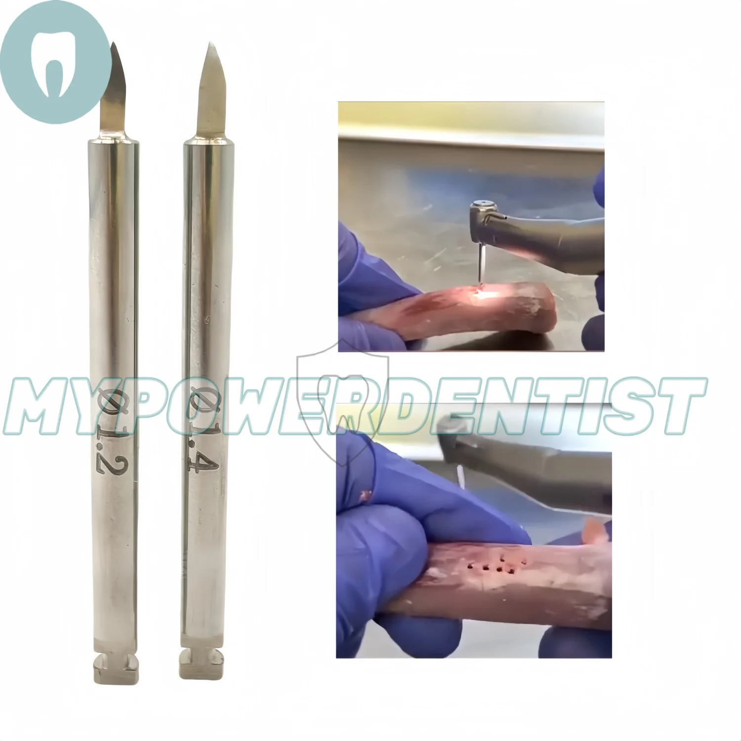 

Dental Nutrient Drill Bone Implant Increment Nutrient Hole Drill GBR Pilot Drill 1.2/1.4