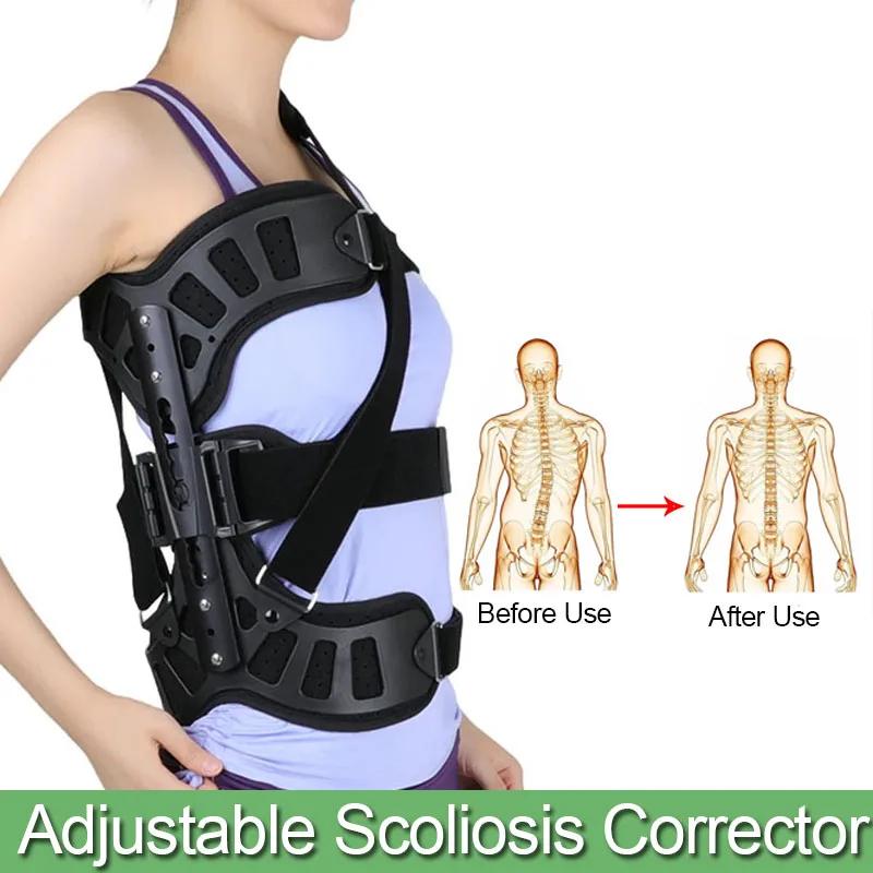 

Adjustable Scoliosis Posture Corrector Adults Health Support Brace Posture Corrector Scoliosis for Back Recovery Thoracolumbar