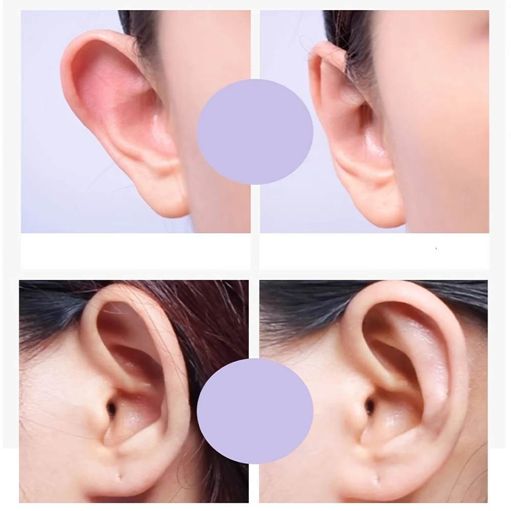 1box-8/Pcs Corrector Cosmetico Discreto de Orejas Sobresalientes de 8 Unidades-Productos Correctivos para el Cuidado de las Orej