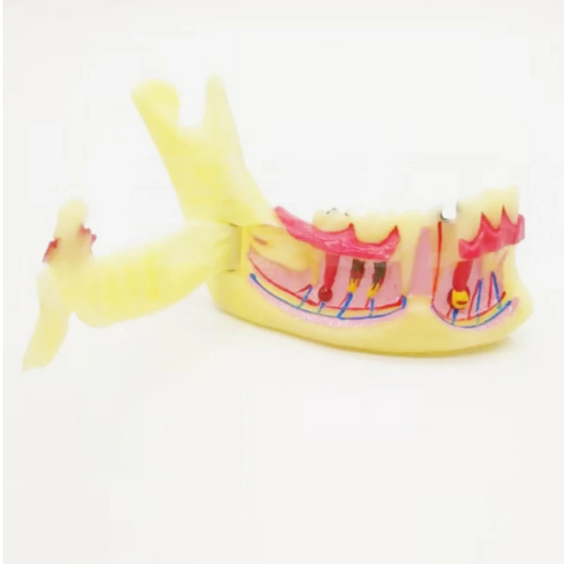 Dental Endodontic Treatment Model Low Jaw Gingiva Mandible Tissue Anatomical Decomposition Model for Learning Teaching ﻿
