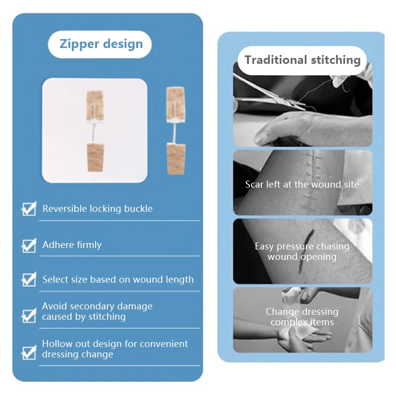 Emergência Zip ponto ferida ataduras, adesivo, sem costura, cortável, sutura rápida, respirável, indolor, bandaid impermeável